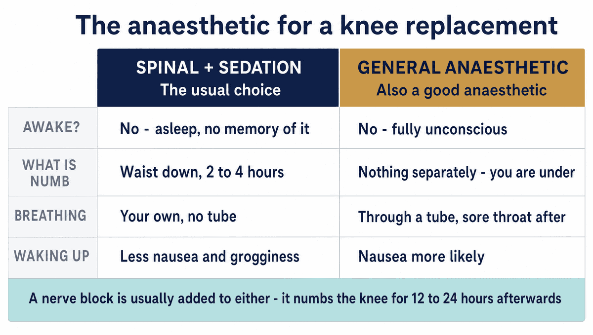 A comparison of a spinal with sedation against a general anaesthetic for a knee replacement. Under both you are asleep and form no memory of the operation. A spinal numbs you from the waist down for two to four hours and needs no breathing tube; a general suspends consciousness and is given through a tube, with a sore throat and nausea more likely afterwards. A nerve block is usually added to either, numbing the knee for twelve to twenty-four hours.