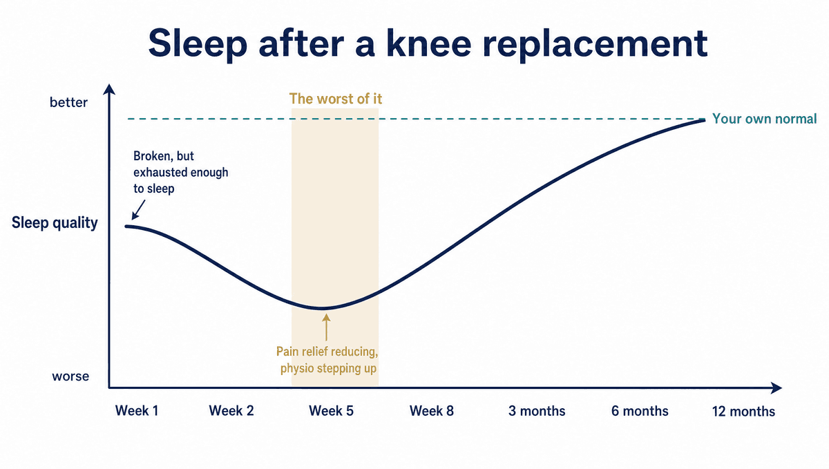 A curve showing sleep quality after a knee replacement: poor but bearable in the first fortnight, worst between weeks four and six, improving unevenly from week eight, broadly settled by three to six months, and back to a person's own baseline between six and twelve months.