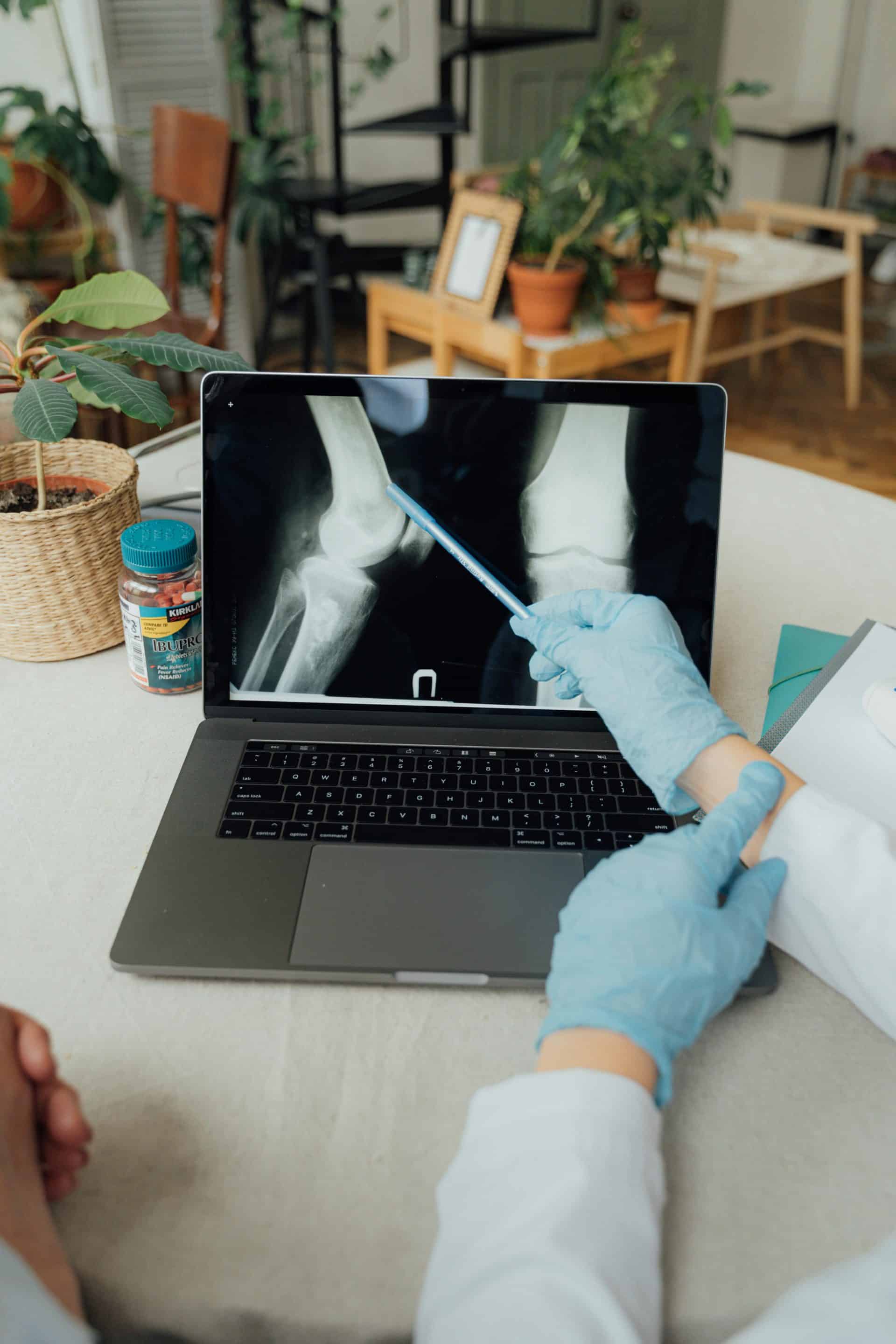 Recovery Journey: Post-Surgery Tips for Knee Replacement Patients in Perth